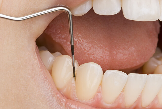当院の歯周病治療の特長